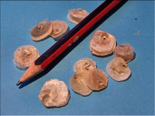 Anomies &eacute;cailleuses